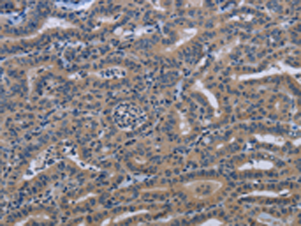Rabbit Polyclonal Antibody to KLHL2