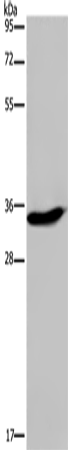 Rabbit Polyclonal Antibody to KLK6