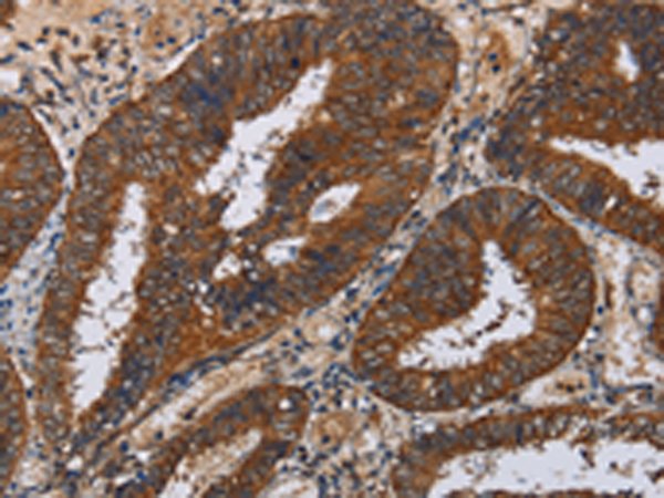 Rabbit Polyclonal Antibody to KLK11