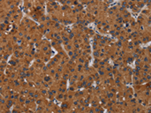 Rabbit Polyclonal Antibody to KLK8