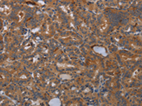 Rabbit Polyclonal Antibody to KLK13