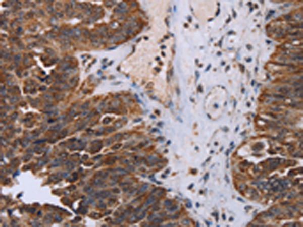 Rabbit Polyclonal Antibody to DDX11