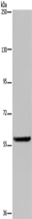 Rabbit Polyclonal Antibody to LBR