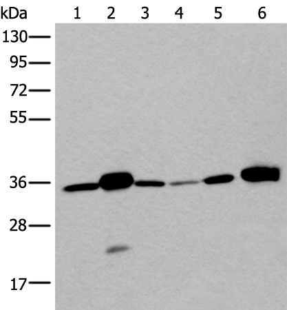 Rabbit Polyclonal Antibody to LDHC