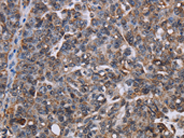 Rabbit Polyclonal Antibody to LDOC1