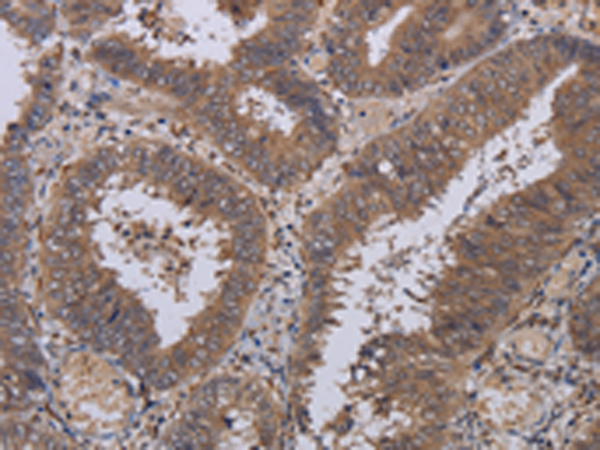 Rabbit Polyclonal Antibody to P3H3