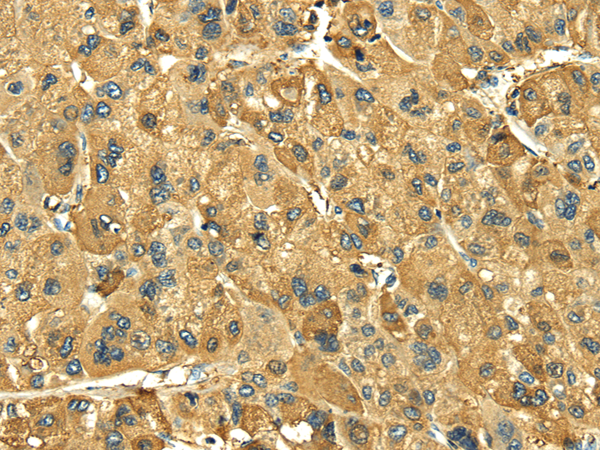 Rabbit Polyclonal Antibody to LEP