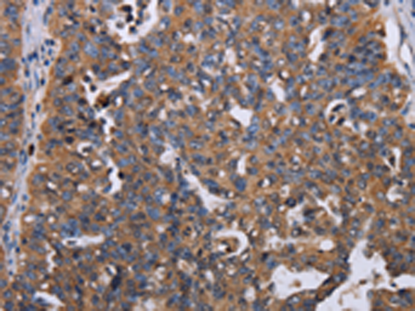 Rabbit Polyclonal Antibody to TRIM13