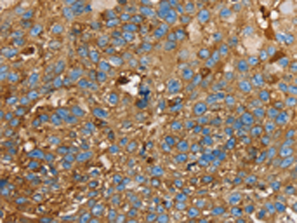 Rabbit Polyclonal Antibody to LGALS3BP