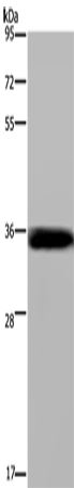 Rabbit Polyclonal Antibody to LIMS1