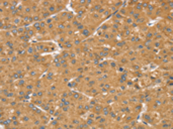 Rabbit Polyclonal Antibody to LMO4