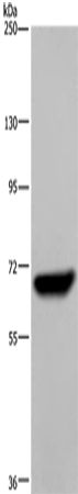 Rabbit Polyclonal Antibody to LCP1