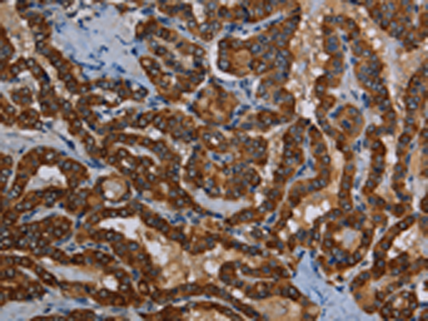 Rabbit Polyclonal Antibody to PIDD1