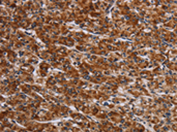 Rabbit Polyclonal Antibody to LRRC15