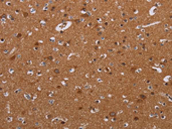 Rabbit Polyclonal Antibody to LUM