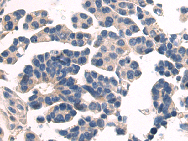 Rabbit Polyclonal Antibody to STRADA