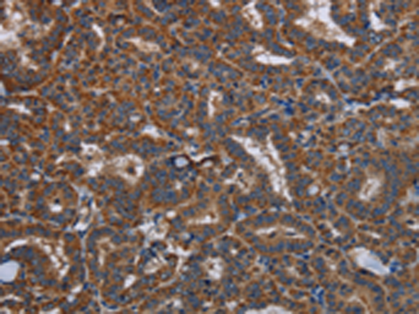 Rabbit Polyclonal Antibody to LYN
