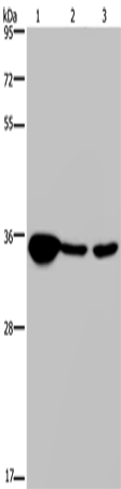 Rabbit Polyclonal Antibody to LZTFL1