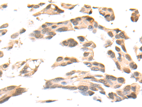 Rabbit Polyclonal Antibody to TAB1