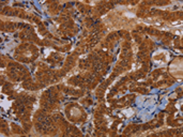 Rabbit Polyclonal Antibody to WDR83