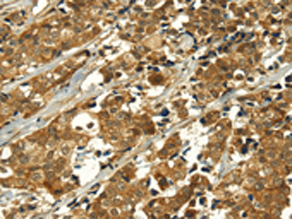 Rabbit Polyclonal Antibody to MAPKAPK5
