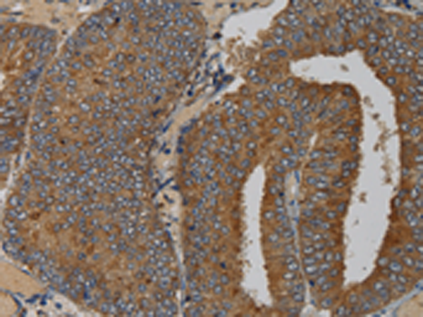 Rabbit Polyclonal Antibody to MAS1