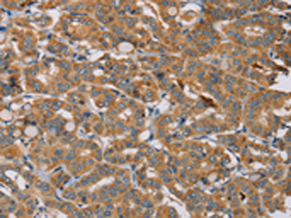 Rabbit Polyclonal Antibody to MBNL3