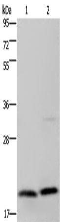 Rabbit Polyclonal Antibody to MCTS1