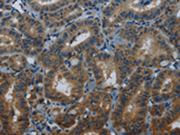 Rabbit Polyclonal Antibody to MEI1