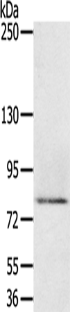Rabbit Polyclonal Antibody to MEP1A