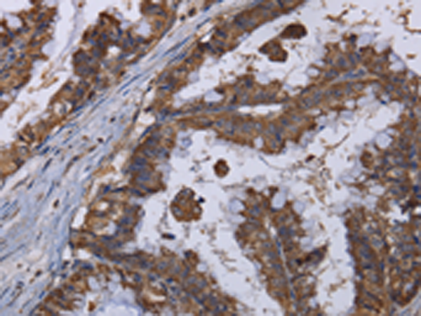 Rabbit Polyclonal Antibody to MT3