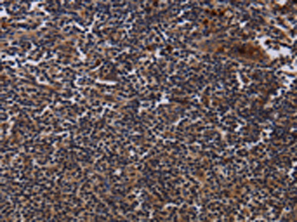 Rabbit Polyclonal Antibody to NTMT1