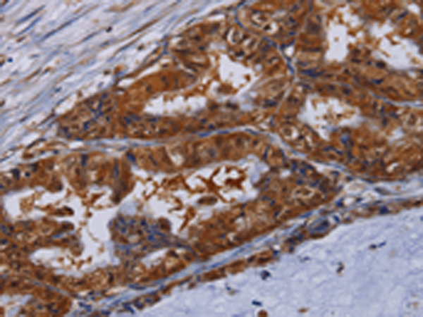 Rabbit Polyclonal Antibody to MFAP3L