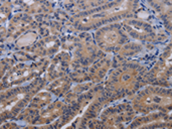 Rabbit Polyclonal Antibody to TRPM8