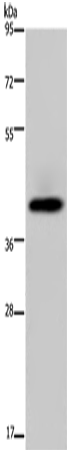 Rabbit Polyclonal Antibody to SERPINB3