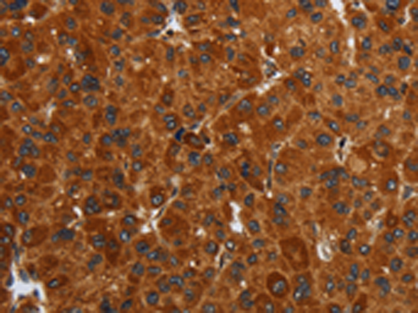 Rabbit Polyclonal Antibody to ENTPD7