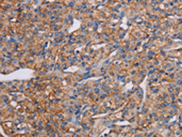 Rabbit Polyclonal Antibody to GHITM
