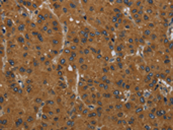 Rabbit Polyclonal Antibody to MIER2