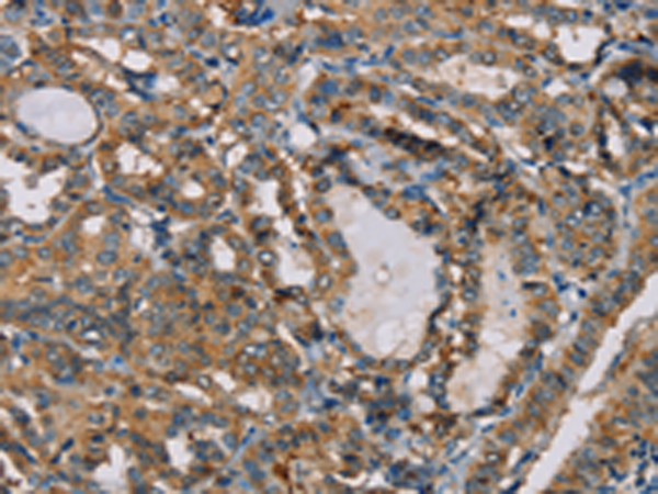 Rabbit Polyclonal Antibody to CENPU