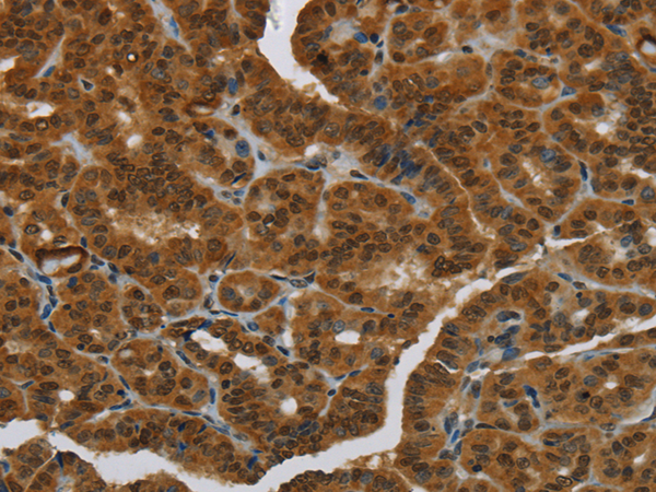 Rabbit Polyclonal Antibody to MRE11