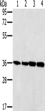 Rabbit Polyclonal Antibody to MRPL39
