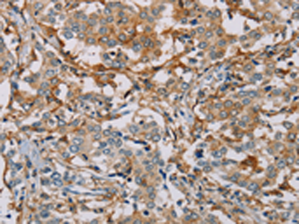 Rabbit Polyclonal Antibody to MSR1