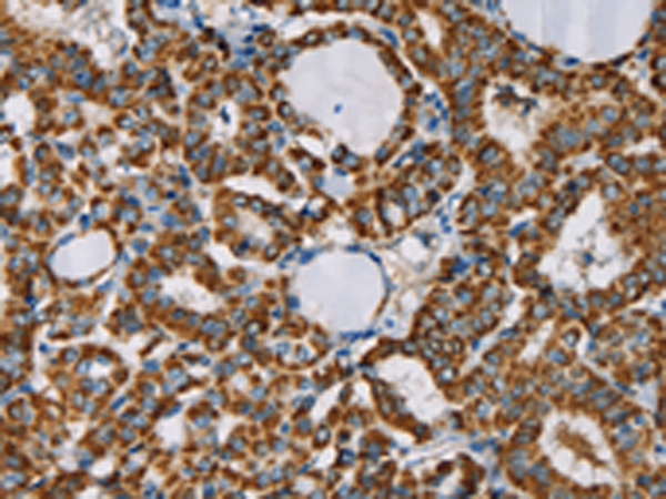 Rabbit Polyclonal Antibody to CMC4