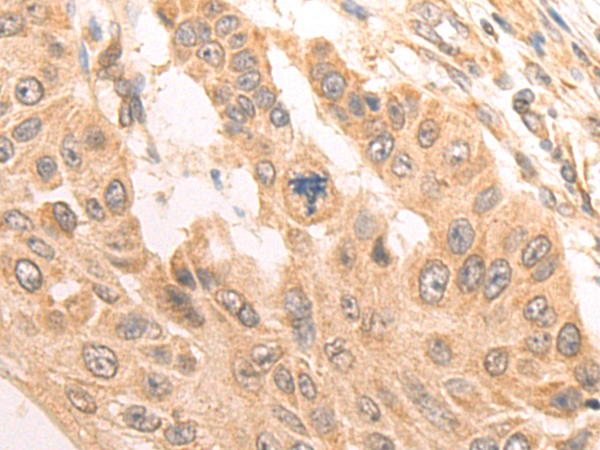 Rabbit Polyclonal Antibody to MTF1
