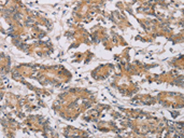 Rabbit Polyclonal Antibody to MTFR1