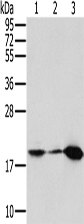 Rabbit Polyclonal Antibody to MTFP1