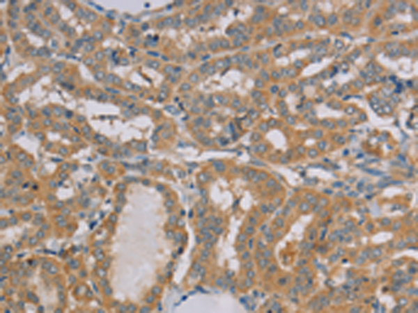 Rabbit Polyclonal Antibody to MTUS1