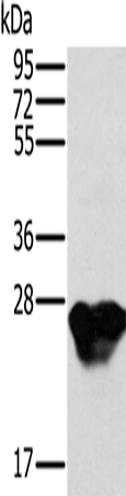 Rabbit Polyclonal Antibody to MYL3