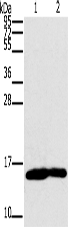 Rabbit Polyclonal Antibody to MB