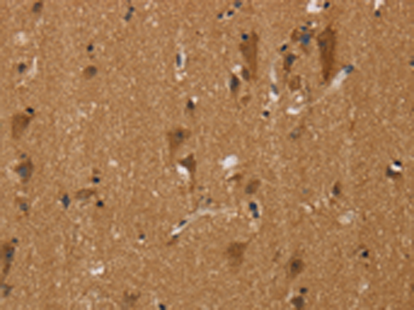 Rabbit Polyclonal Antibody to BEX3